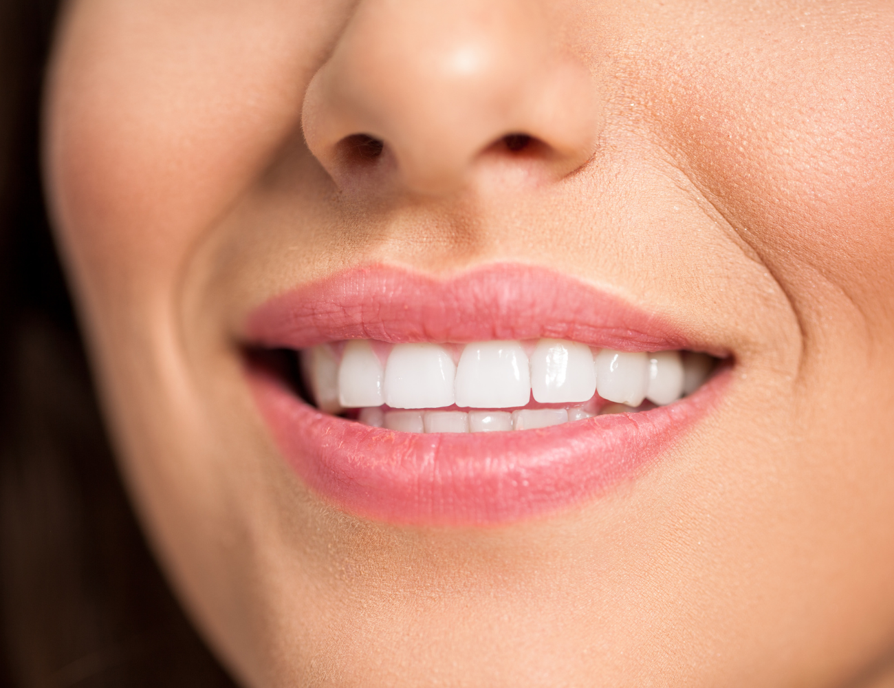 Sonrisa gingival Murcia